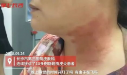 痒视频,揭秘短视频时代的痒点与共鸣